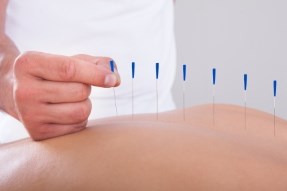 China Health: Acupunture to treat fertility