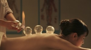 Hot cupping in Ipswich by China Health